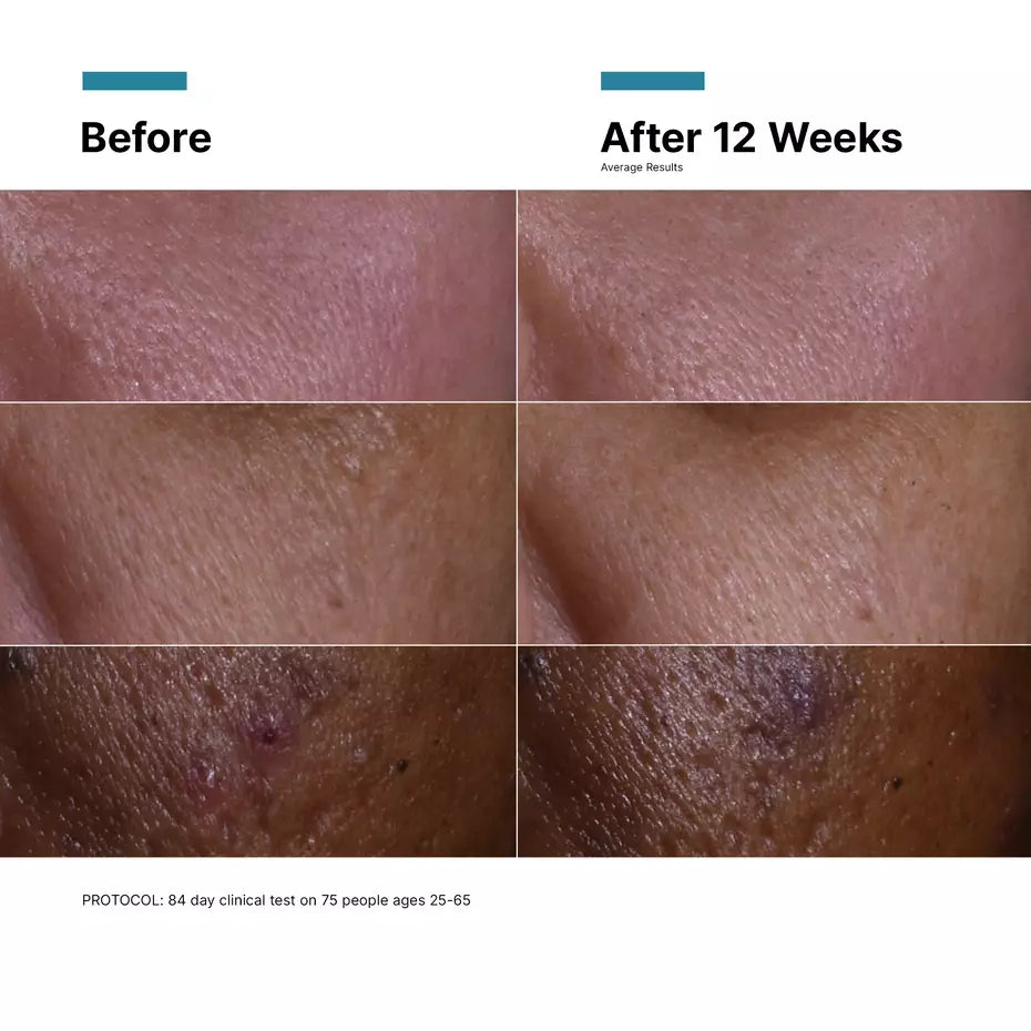 skinceuticals C E Ferulic® with 15% L-Ascorbic Acid